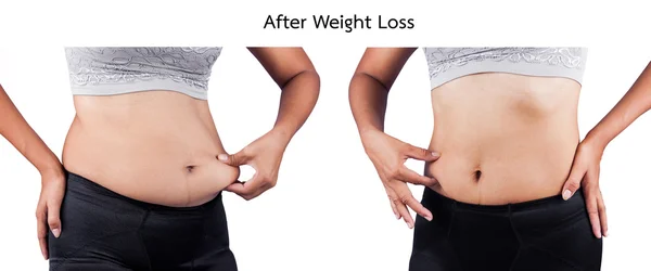 Women body fat belly between before and after weight loss — Stock Photo, Image