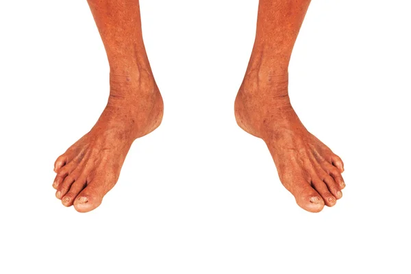 Нога літнього чоловіка ізольований фон — стокове фото