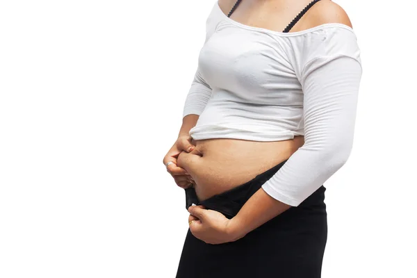 Test nő kövér hasa, és Stretch Mark — Stock Fotó