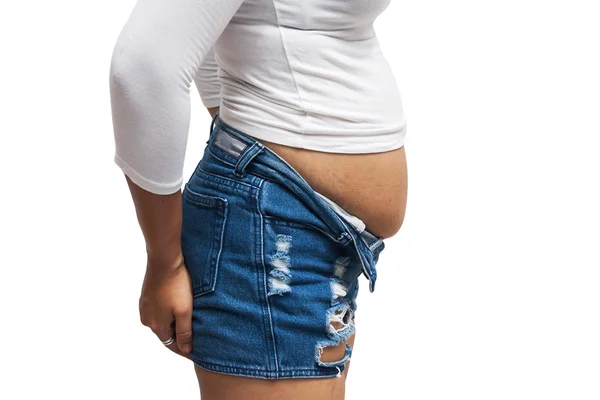 Frauen Körperfettbauch und Kratzspuren — Stockfoto