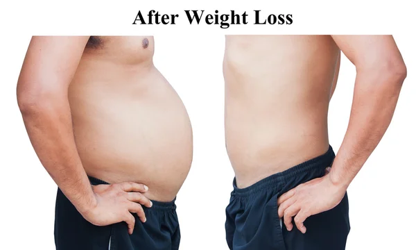 Different of man body before and after,after weight loss — Stock Photo, Image