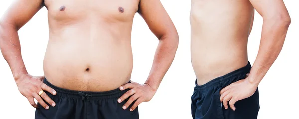 Vor und nach dem Körper Mann dicken Bauch nach der Gewichtsabnahme — Stockfoto