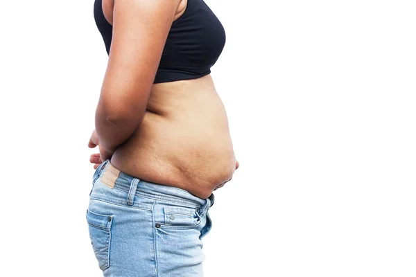 Vrouwen lichaam met dikke buik en striae — Stockfoto