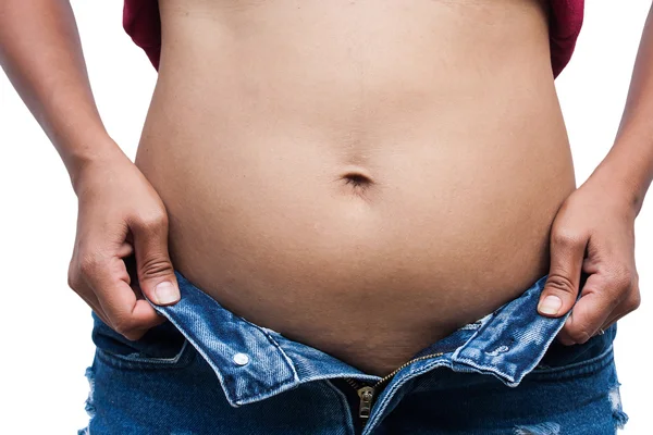 Frauen mit dickem Bauch und Dehnungsstreifen, Vorderseite — Stockfoto