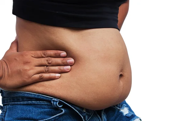 Kövér hasa, és a striák, a nők az előlap — Stock Fotó
