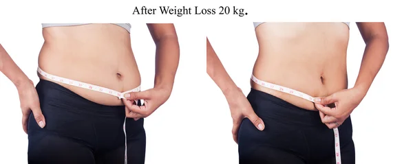 Women measuring belly fat itself,before and after weight loss — Stock Photo, Image