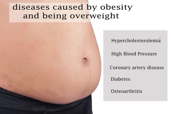 Ziekten die worden veroorzaakt door obesitas en overgewicht — Stockfoto