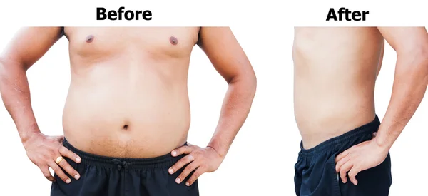 Antes e depois da barriga gorda do homem do corpo após a perda de peso — Fotografia de Stock