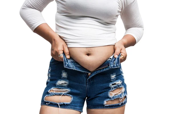 Mulheres barriga de gordura corporal e marca de arranhão — Fotografia de Stock