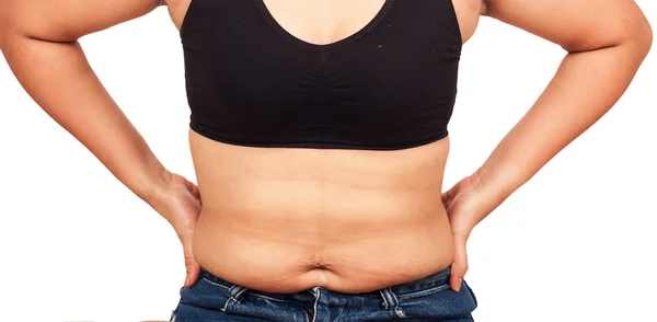 Mulheres barriga de gordura corporal e estrias — Fotografia de Stock