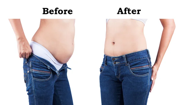 Women body before and after fat belly — Stock Photo, Image