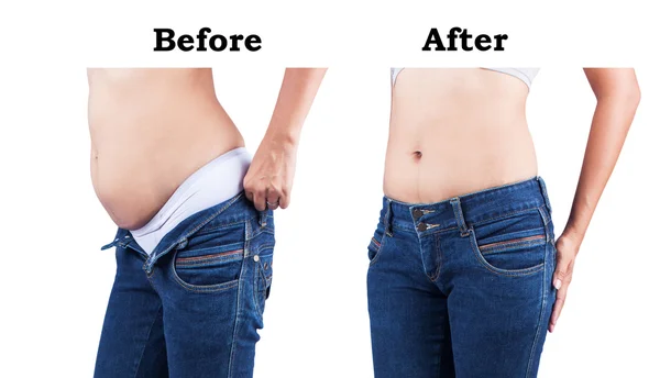 Tělo ženy před a po tuku břicho — Stock fotografie