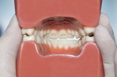 Diş model iç görünümü