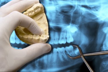 dentist hand show molar teeth clipart