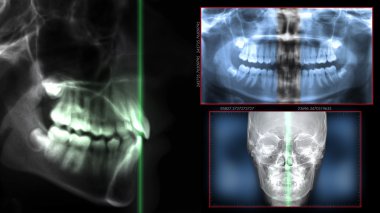 laser radiography technology clipart