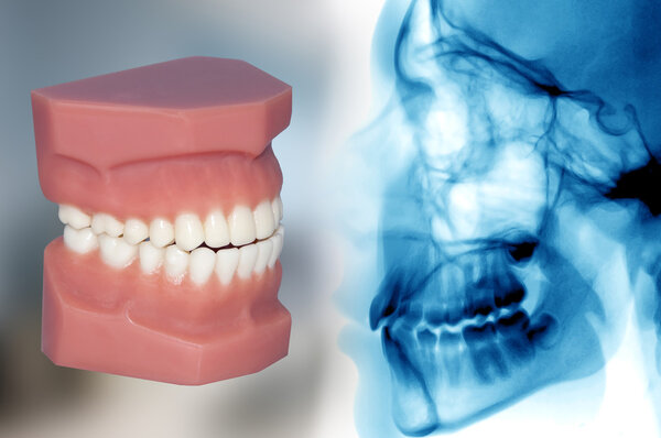teeth model and x-ray