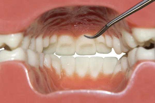 Interior mouth view — Stock Photo, Image