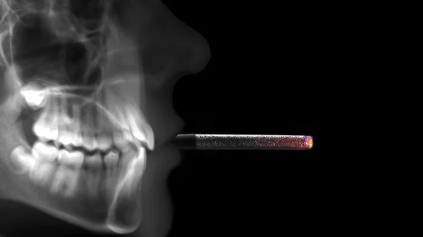 담배 불로 방사선 — 스톡 사진