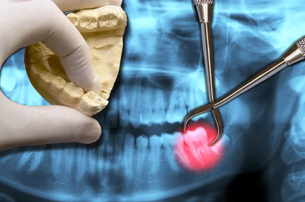 Dentysta ręka Pokaż zęba trzonowego — Zdjęcie stockowe