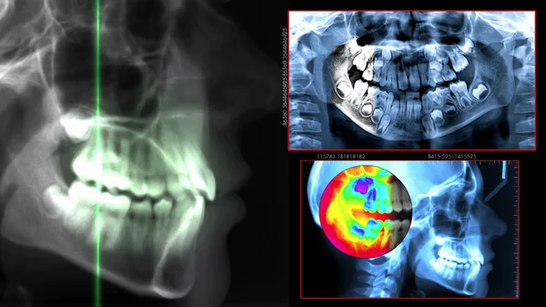 Dental scan diagnostic — Stock Photo, Image