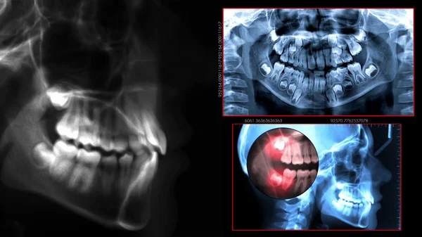 Radiography dental scan — Stock Photo, Image