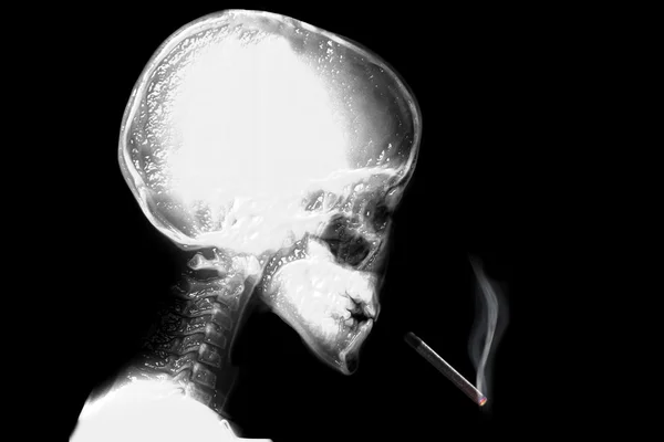 Скелет з сигаретою падає — стокове фото