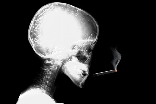 금연을 하는 해골 — 스톡 사진
