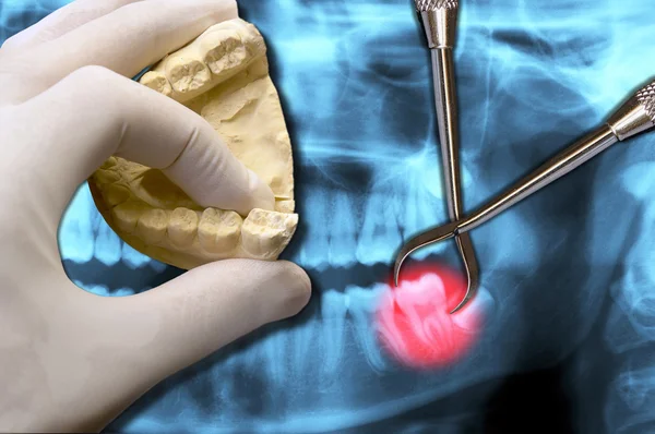 Mostrar los dientes molares dolor de muelas — Foto de Stock