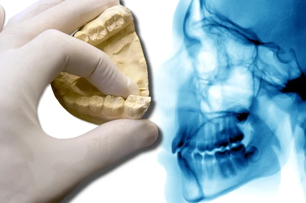 Hand show dental model over x-ray — Stock Photo, Image