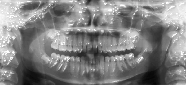 3d raio-x dental — Fotografia de Stock