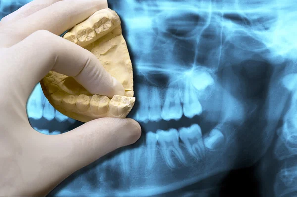 Dentist hand  over x-ray — Stock Photo, Image