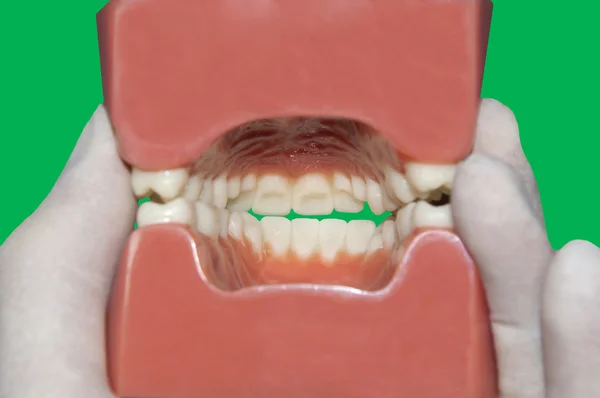 View of interior mouth: Green Screen/ Chroma key — Stock Photo, Image