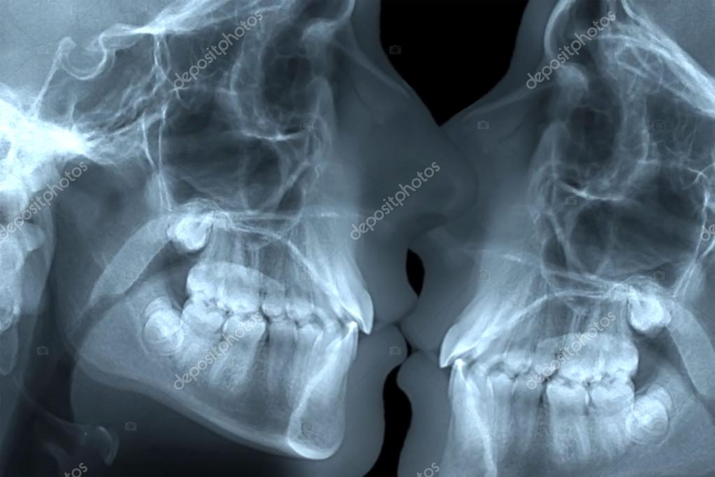 RADIOGRAFIE SCARICA