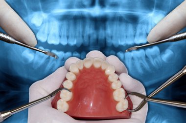 Ortodonti araçları cerrahi simülasyon