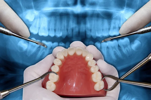 Herramientas de ortodoncia simulación de cirugía — Foto de Stock