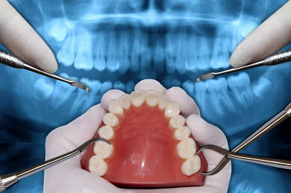 Herramientas de ortodoncia simulación de cirugía —  Fotos de Stock
