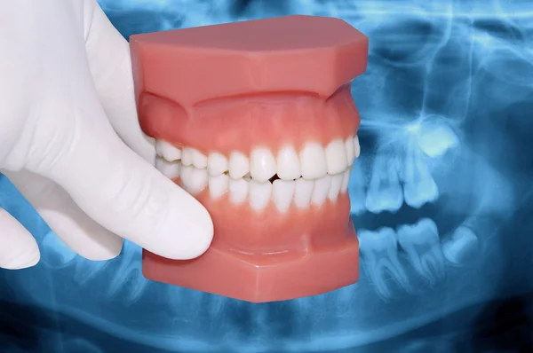 Dentist hand show dental model over x-ray — Stock Photo, Image