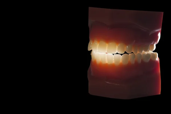 Dental tänder gjuta bakgrundsbelysning isolerade på svart — Stockfoto