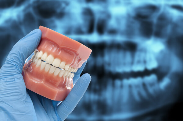 dentist hand show dental mould smiling over ct dental scan