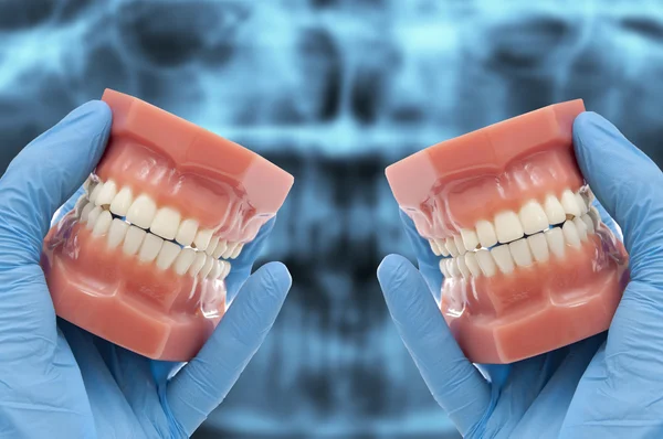 Manos muestran resultados de tratamiento de ortodoncia — Foto de Stock