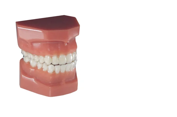 Dental mould with invisible orthodontic removable retainer — Stock Photo, Image