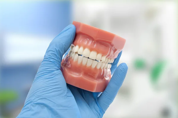 Orthodontische resultaten met de vazal van de onzichtbare aligners — Stockfoto