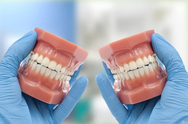 Dentista muestran resultados de tratamiento de ortodoncia estética sonriendo —  Fotos de Stock