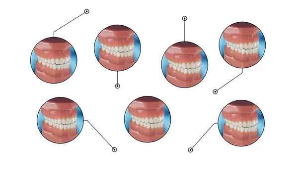 Grafica ortodontica invisibile del fermo macchina — Foto Stock