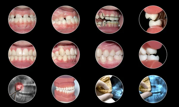 Odontológico elementos infográficos médicos coleta de ortodontia — Fotografia de Stock