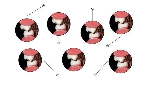 Tandvård infographic kindtänderna tänder ocklusion — Stockfoto