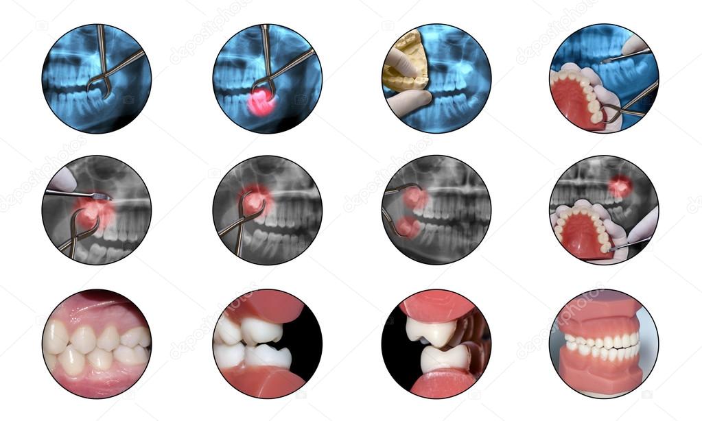 Orthodontic Fetish