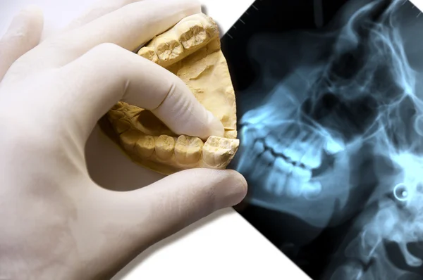 Dentist hand hold teeth model with x-ray — Stock Photo, Image