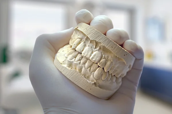 hand show model teeth