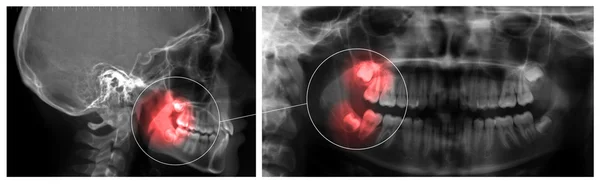 Orthopanoramic and Cephalometry — Stock Photo, Image